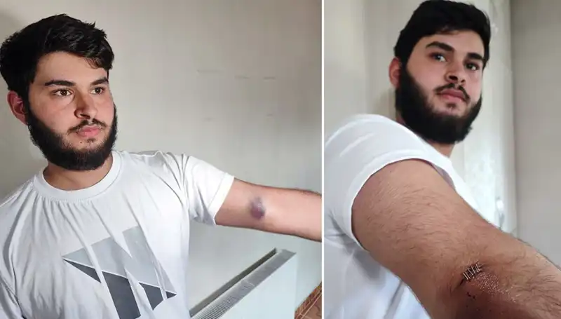 Bahçede Kaybolan Top, Mahallede Sıra Dışı Olaylar Yarattı